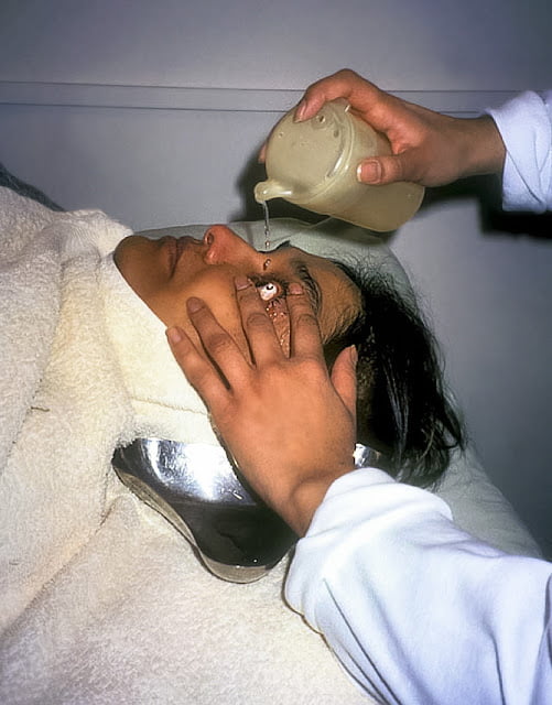 eye cleaning by water