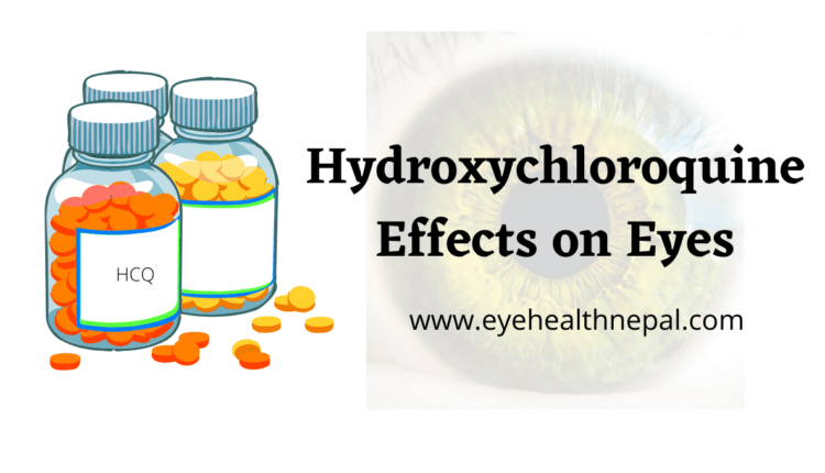 Hydroxychloroquine Effects on Eyes (1)