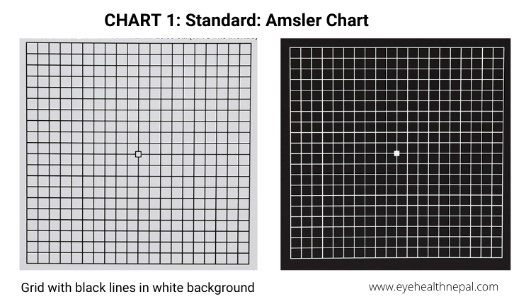 Amsler grid CHART 1: Standard: Amsler Chart