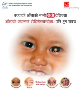 Retinoblastoma Awareness pOster Nepali