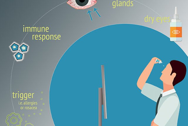 New-cause-of-dry-eye