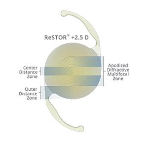 multifocal IOL