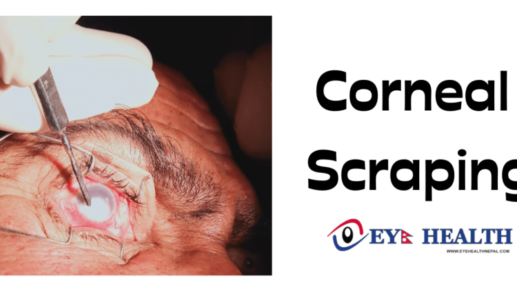 Corneal scraping procedure