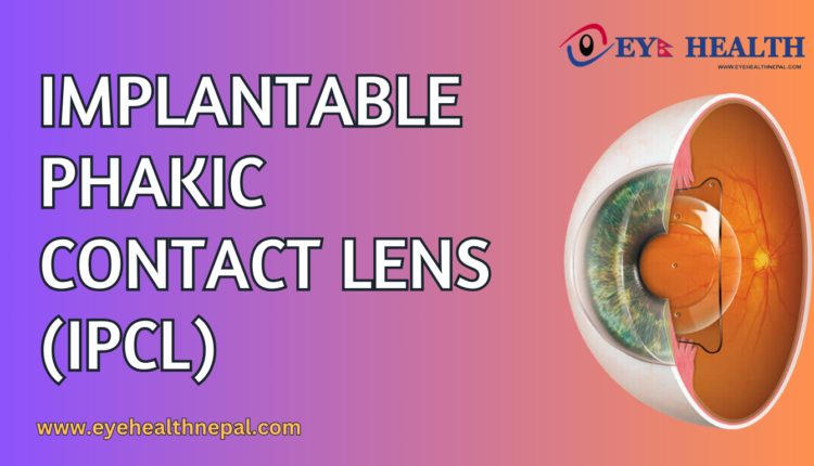 Implantable Phakic Contact Lens (IPCL)
