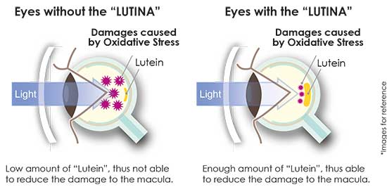 Standard vs Lutina Material Lens