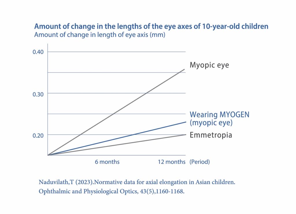 Tokai's sweet spots of the honeycomb for myopia control - Insight